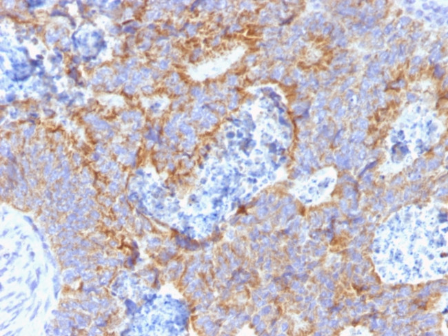 Carcinoembryonic Antigen (CEA)/CD66 Antibody in Immunohistochemistry (Paraffin) (IHC (P))