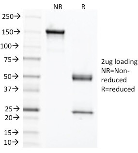 Carcinoembryonic Antigen (CEA)/CD66 Antibody in SDS-PAGE (SDS-PAGE)