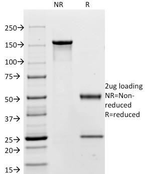 Carcinoembryonic Antigen (CEA)/CD66 Antibody in SDS-PAGE (SDS-PAGE)