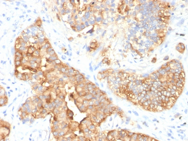 Carcinoembryonic Antigen (CEA)/CD66 Antibody in Immunohistochemistry (Paraffin) (IHC (P))