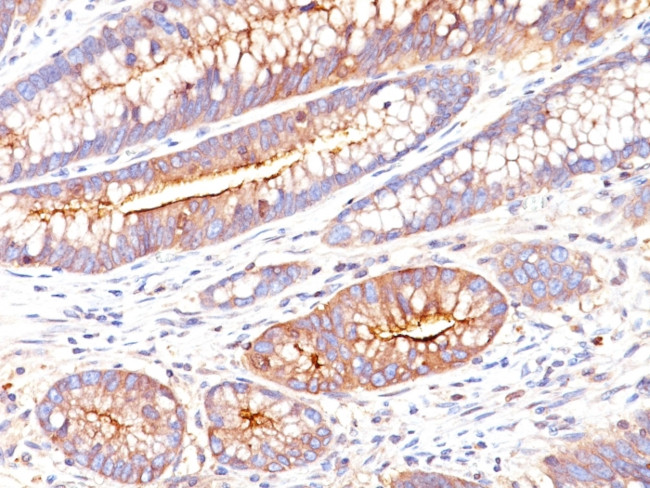 Carcinoembryonic Antigen (CEA)/CD66 Antibody in Immunohistochemistry (Paraffin) (IHC (P))