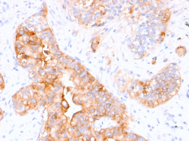 Carcinoembryonic Antigen (CEA)/CD66 Antibody in Immunohistochemistry (Paraffin) (IHC (P))