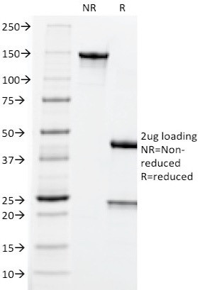 Carcinoembryonic Antigen (CEA)/CD66 Antibody in SDS-PAGE (SDS-PAGE)