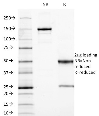 Carcinoembryonic Antigen (CEA)/CD66 Antibody in SDS-PAGE (SDS-PAGE)