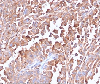 Carcinoembryonic Antigen (CEA)/CD66 Antibody in Immunohistochemistry (Paraffin) (IHC (P))