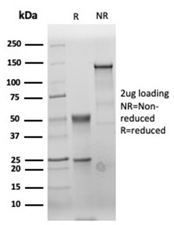 Carcinoembryonic Antigen (CEA)/CD66 Antibody in SDS-PAGE (SDS-PAGE)