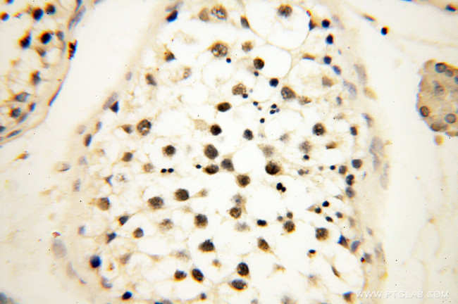 JUNB Antibody in Immunohistochemistry (Paraffin) (IHC (P))