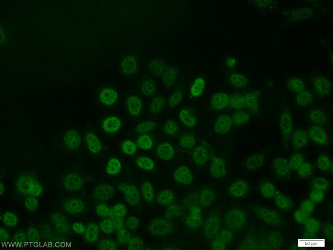 JUNB Antibody in Immunocytochemistry (ICC/IF)