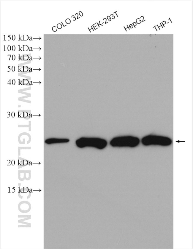 STARD5 Antibody in Western Blot (WB)