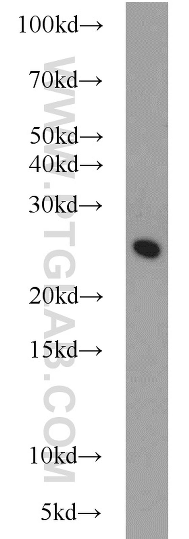 STARD5 Antibody in Western Blot (WB)