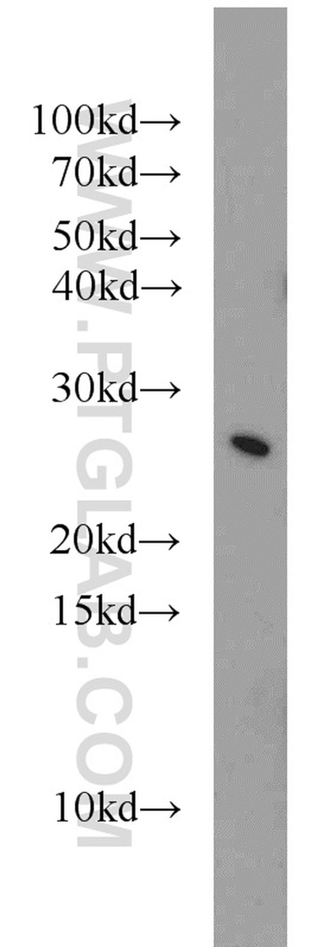 STARD5 Antibody in Western Blot (WB)