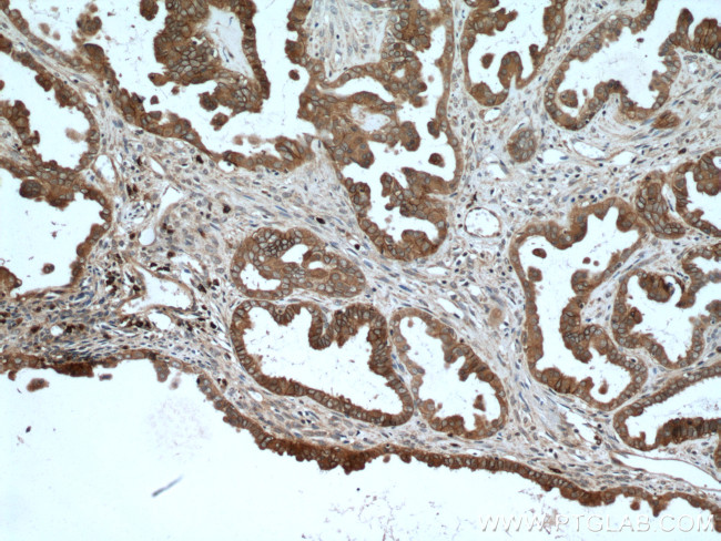 S100A14 Antibody in Immunohistochemistry (Paraffin) (IHC (P))