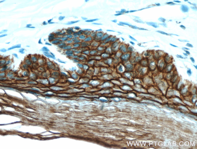 S100A14 Antibody in Immunohistochemistry (Paraffin) (IHC (P))