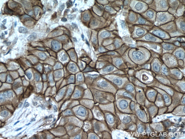 S100A14 Antibody in Immunohistochemistry (Paraffin) (IHC (P))