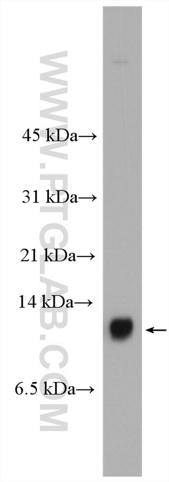 S100A14 Antibody in Western Blot (WB)