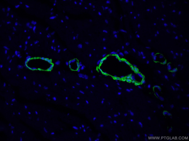 transgelin/SM22 Antibody in Immunohistochemistry (PFA fixed) (IHC (PFA))