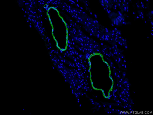 transgelin/SM22 Antibody in Immunohistochemistry (PFA fixed) (IHC (PFA))