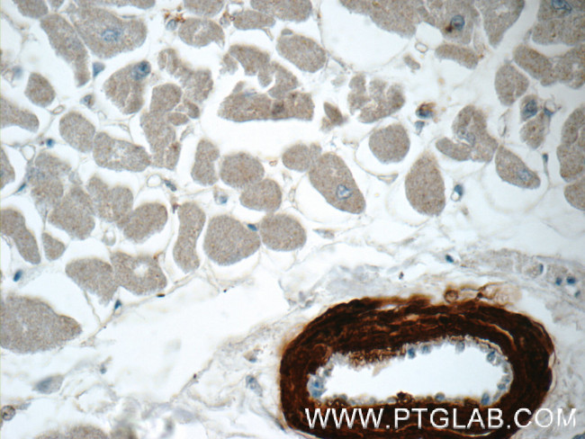 transgelin/SM22 Antibody in Immunohistochemistry (Paraffin) (IHC (P))