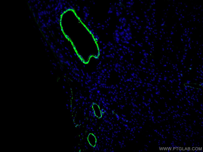 transgelin/SM22 Antibody in Immunohistochemistry (PFA fixed) (IHC (PFA))