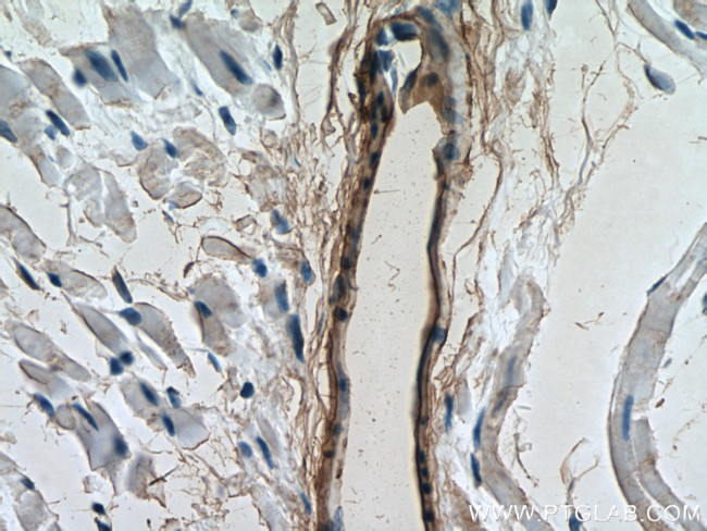 transgelin/SM22 Antibody in Immunohistochemistry (Paraffin) (IHC (P))