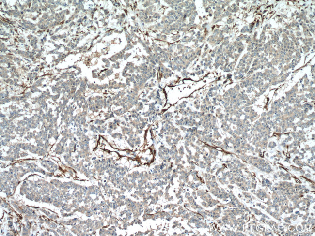 transgelin/SM22 Antibody in Immunohistochemistry (Paraffin) (IHC (P))