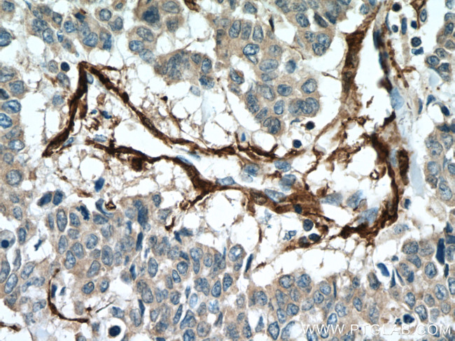 transgelin/SM22 Antibody in Immunohistochemistry (Paraffin) (IHC (P))