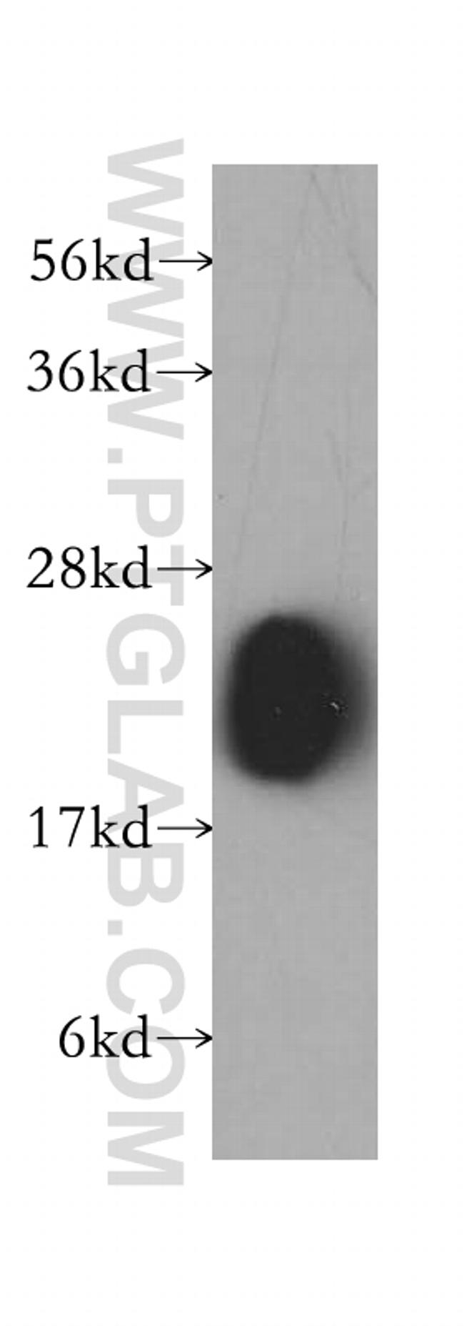 transgelin/SM22 Antibody in Western Blot (WB)