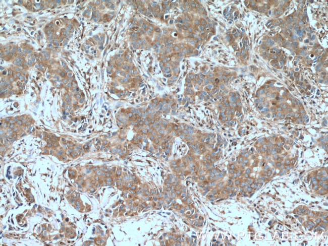 GAPDH Antibody in Immunohistochemistry (Paraffin) (IHC (P))