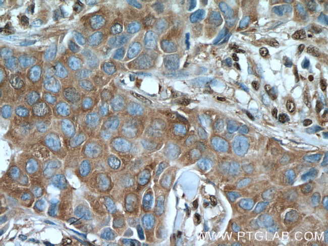 GAPDH Antibody in Immunohistochemistry (Paraffin) (IHC (P))