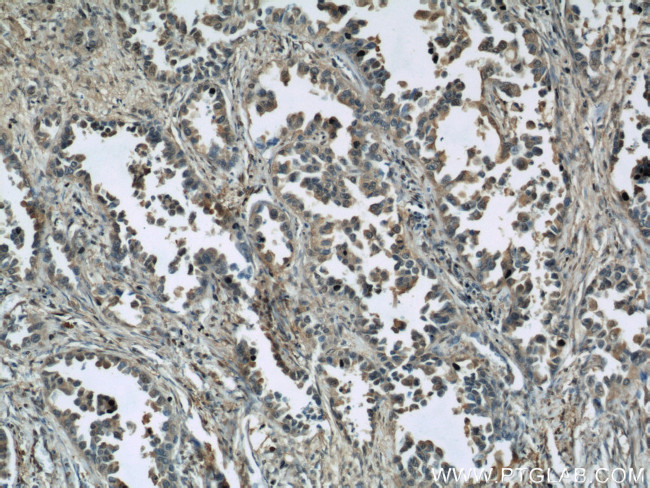 GAPDH Antibody in Immunohistochemistry (Paraffin) (IHC (P))