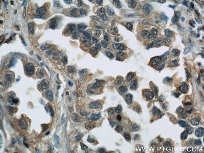 GAPDH Antibody in Immunohistochemistry (Paraffin) (IHC (P))