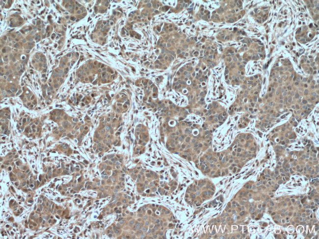 GAPDH Antibody in Immunohistochemistry (Paraffin) (IHC (P))