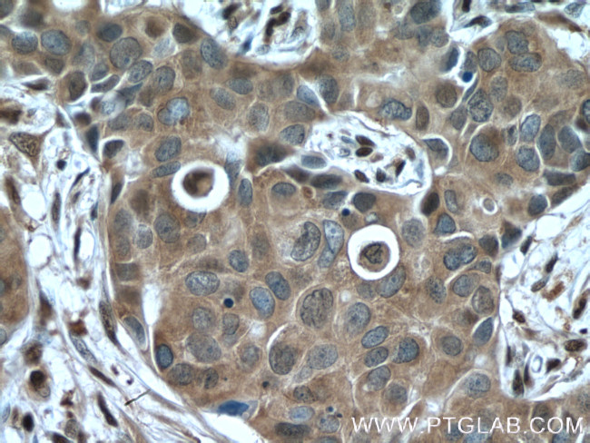 GAPDH Antibody in Immunohistochemistry (Paraffin) (IHC (P))