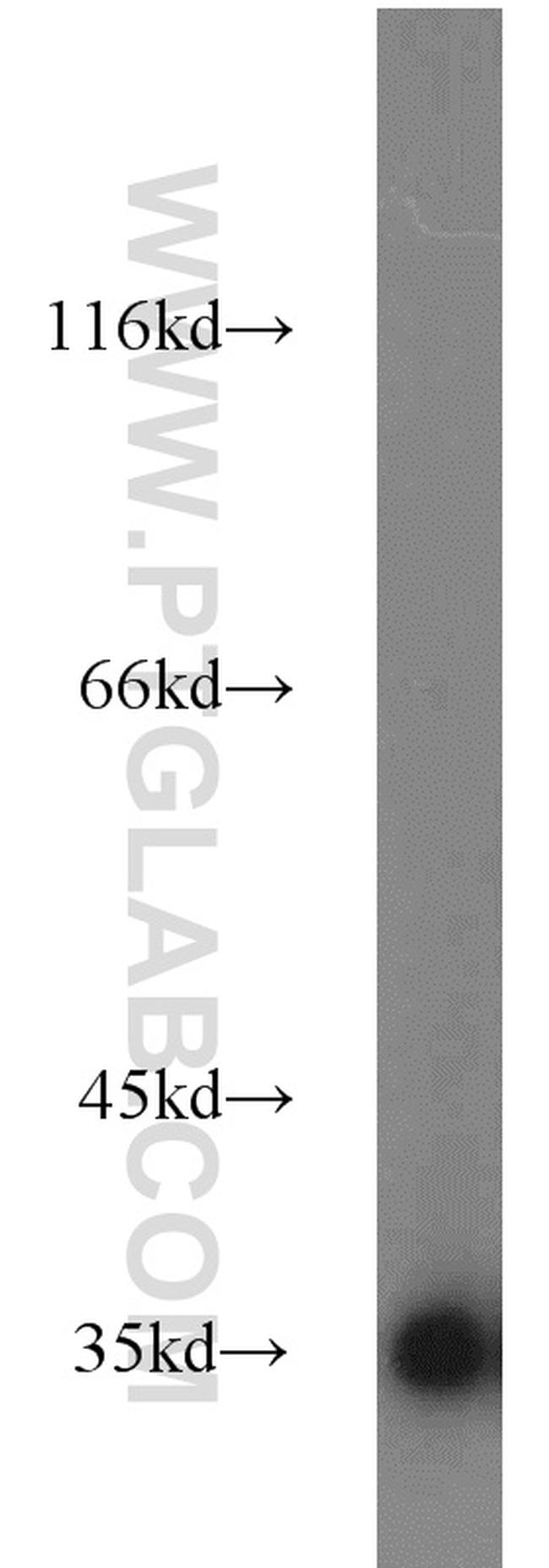 GAPDH Antibody in Western Blot (WB)