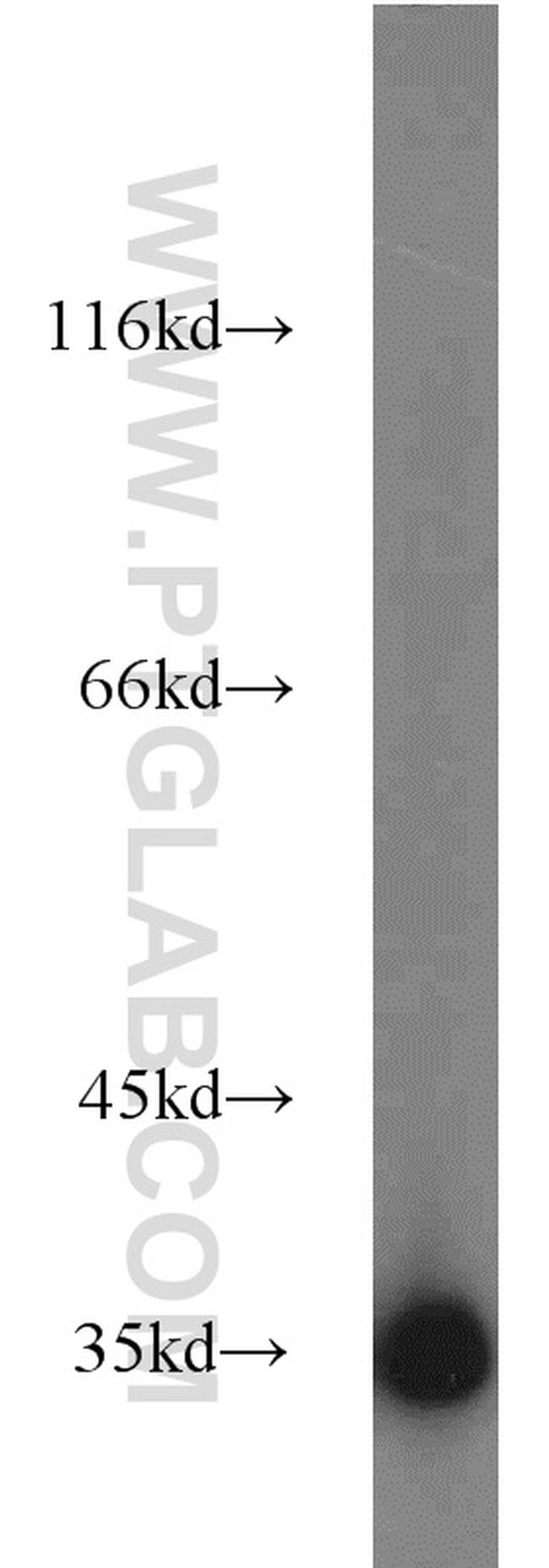 GAPDH Antibody in Western Blot (WB)