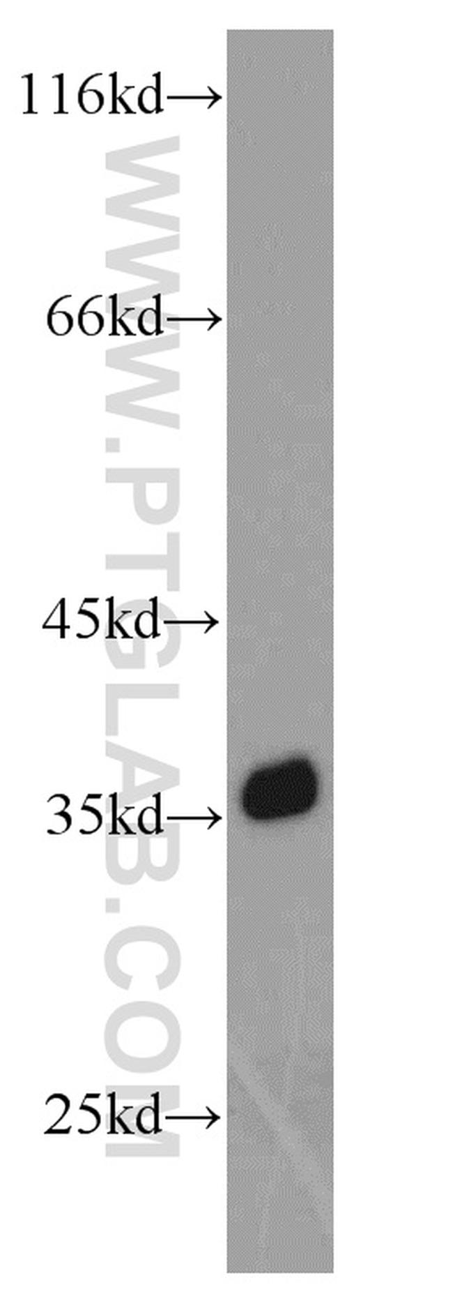 GAPDH Antibody in Western Blot (WB)