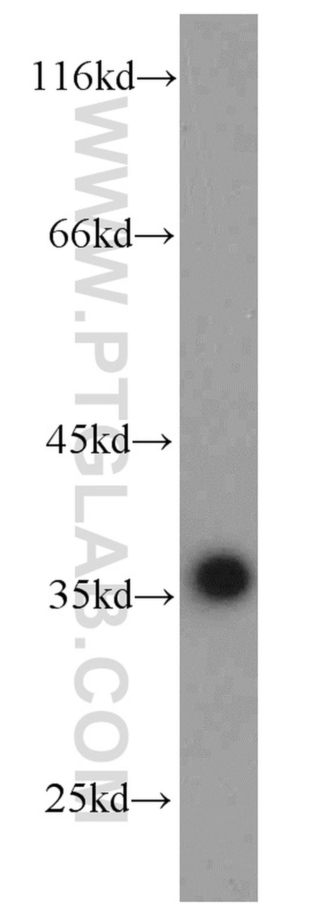 GAPDH Antibody in Western Blot (WB)