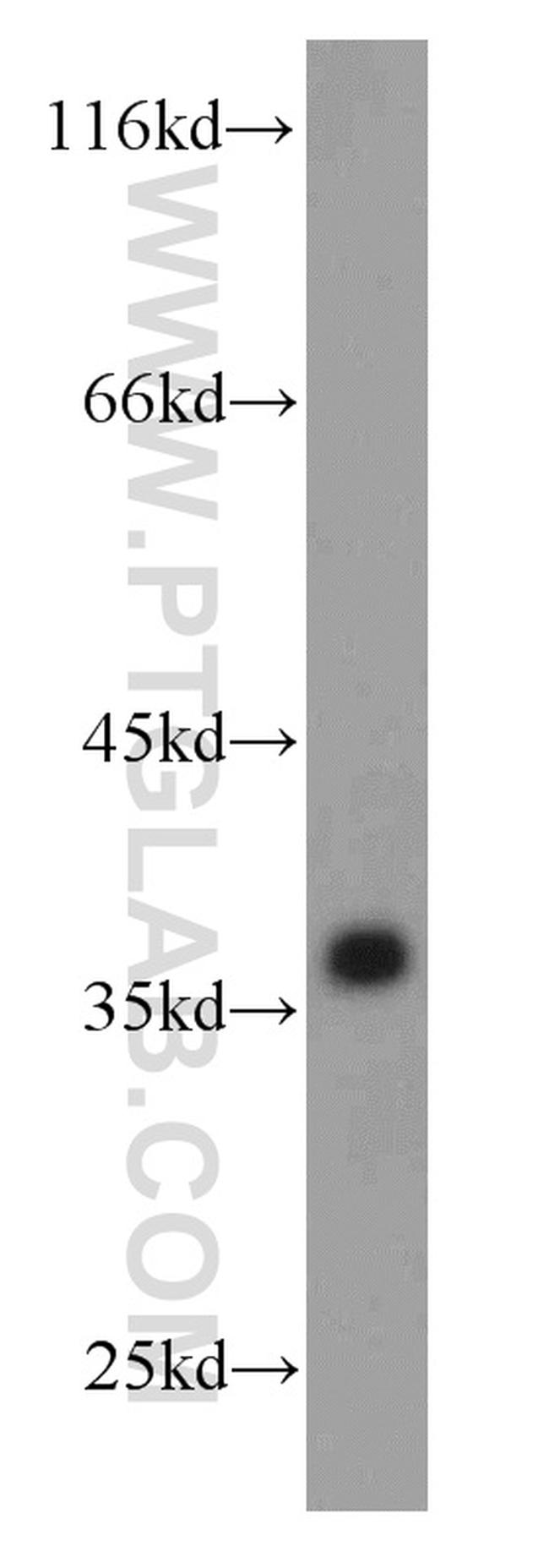 GAPDH Antibody in Western Blot (WB)