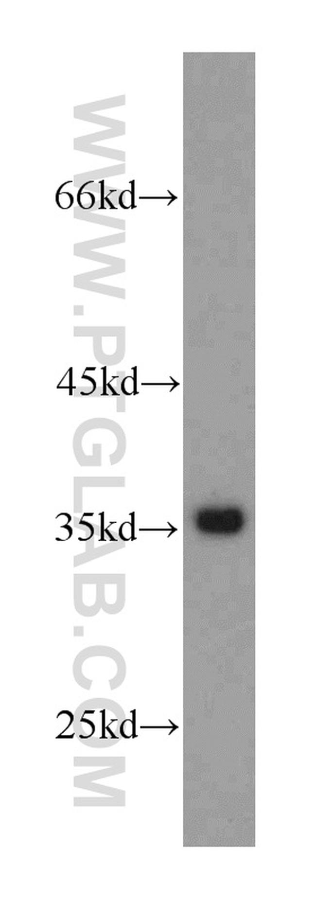 GAPDH Antibody in Western Blot (WB)