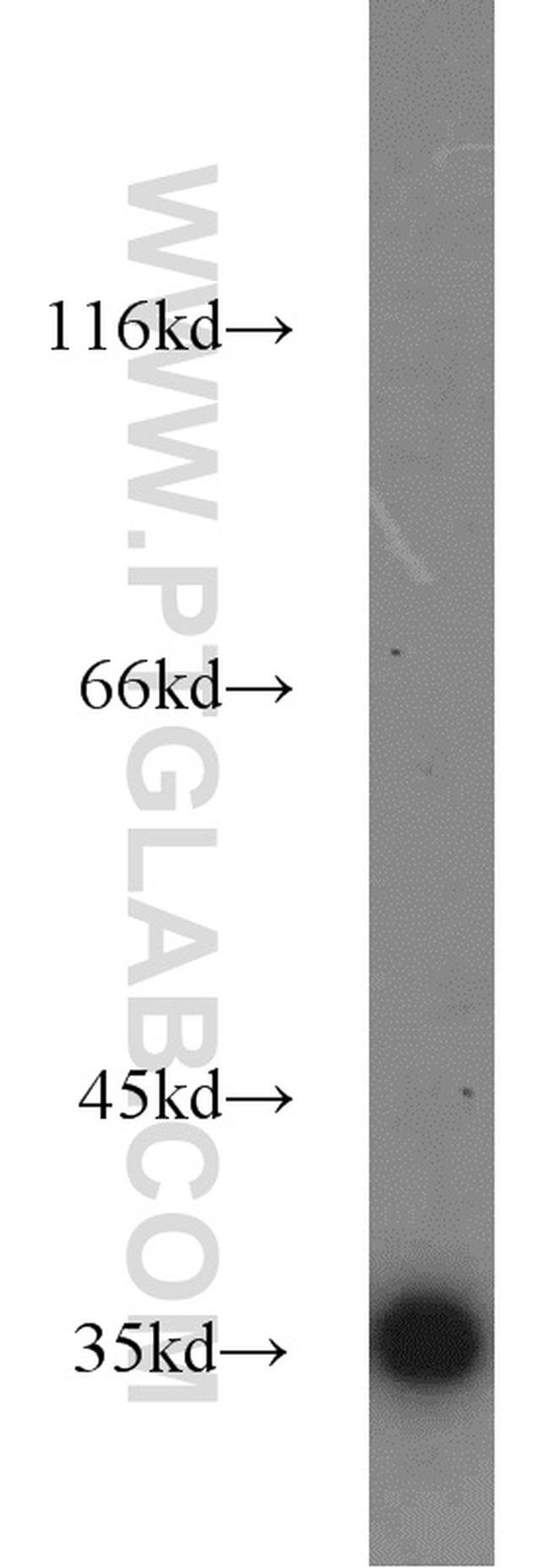 GAPDH Antibody in Western Blot (WB)