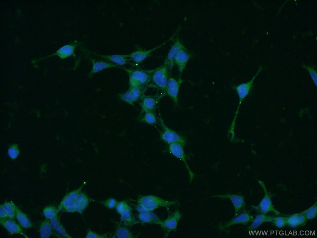 PIN1 Antibody in Immunocytochemistry (ICC/IF)