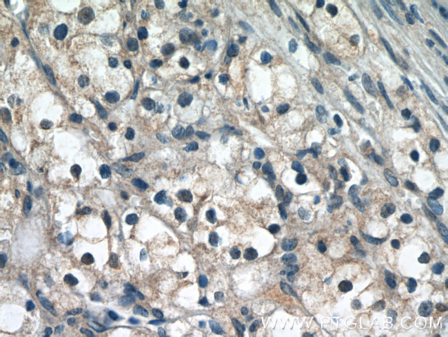 PIN1 Antibody in Immunohistochemistry (Paraffin) (IHC (P))