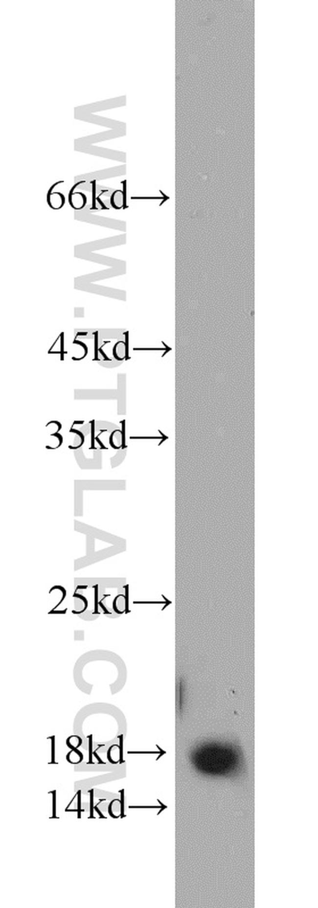 PIN1 Antibody in Western Blot (WB)