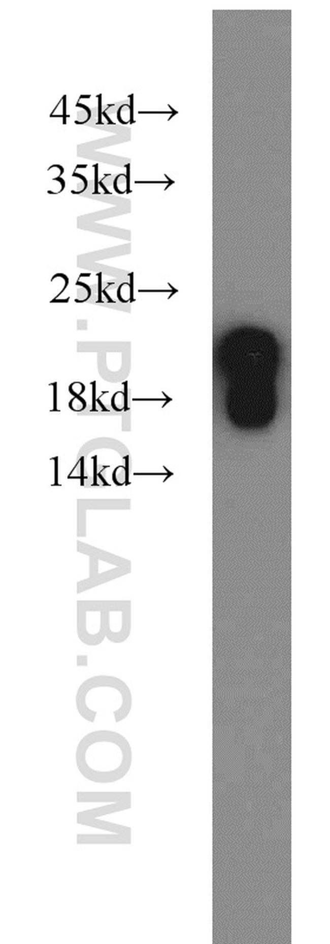 SNCB Antibody in Western Blot (WB)