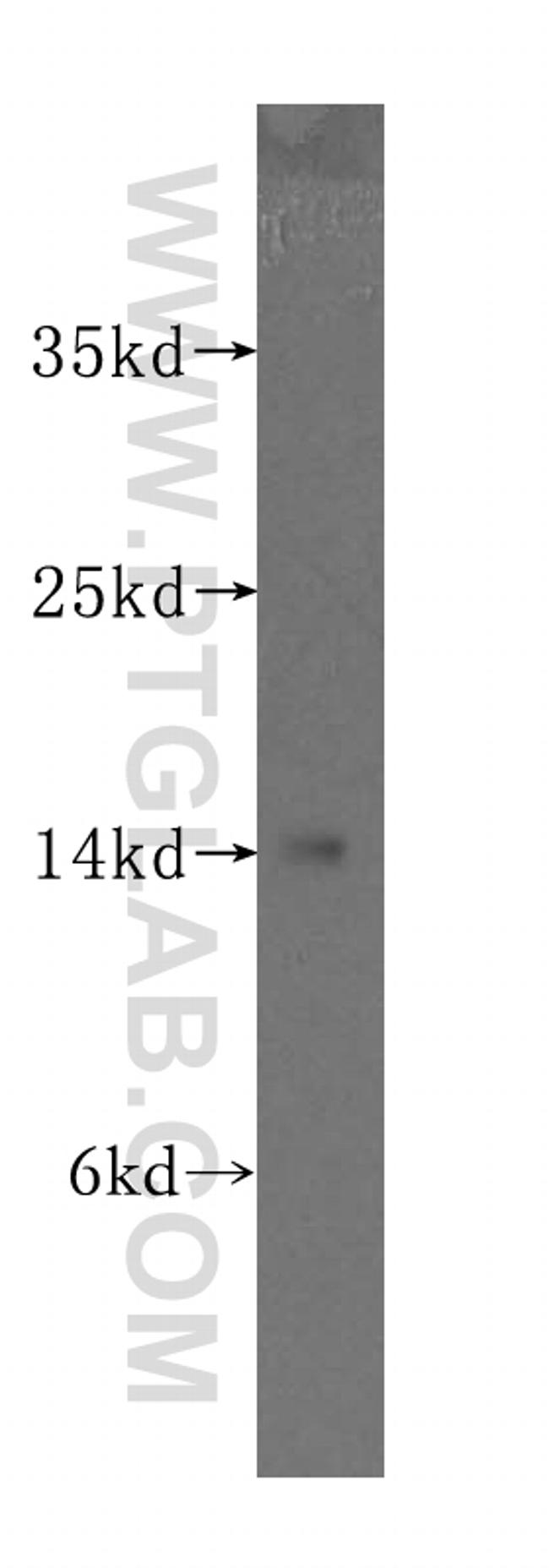 SNCB Antibody in Western Blot (WB)