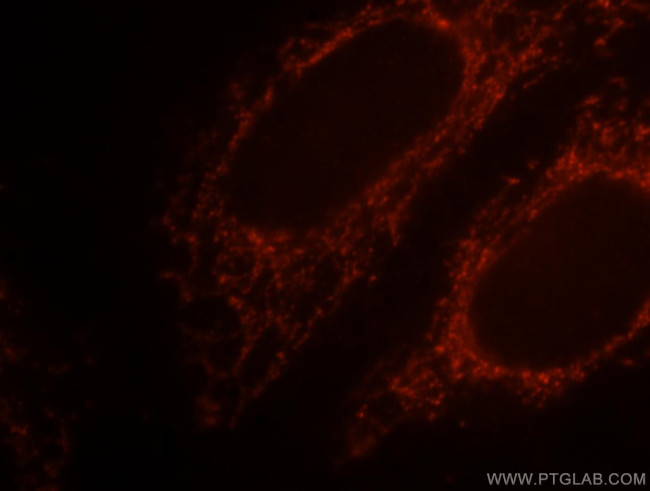 SNCB Antibody in Immunocytochemistry (ICC/IF)