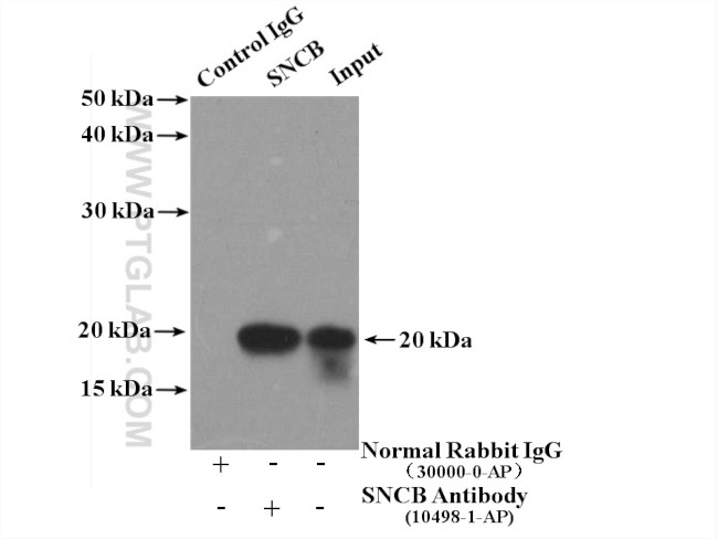 SNCB Antibody in Immunoprecipitation (IP)