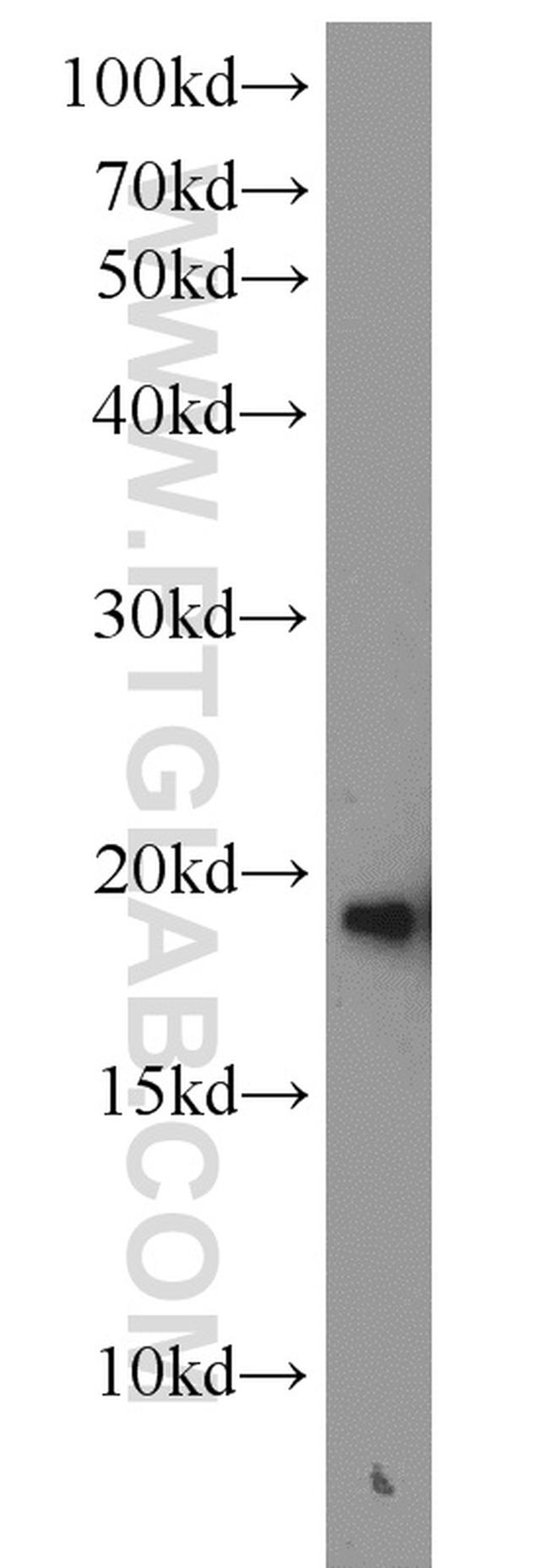 SNCB Antibody in Western Blot (WB)