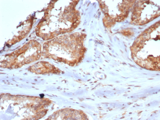 CARM1 Antibody in Immunohistochemistry (Paraffin) (IHC (P))