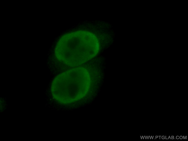 TFII I Antibody in Immunocytochemistry (ICC/IF)